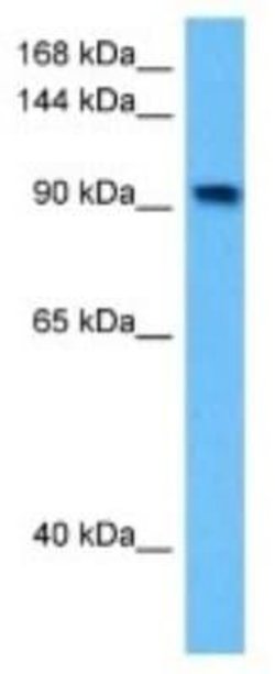 Ataxin-2-like protein Rabbit anti-Human, Polyclonal, Novus Biologicals:Antibodies:Primary